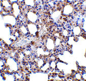 IHC - Blimp-1 Antibody ASC10481
